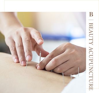 美容鍼灸のこと